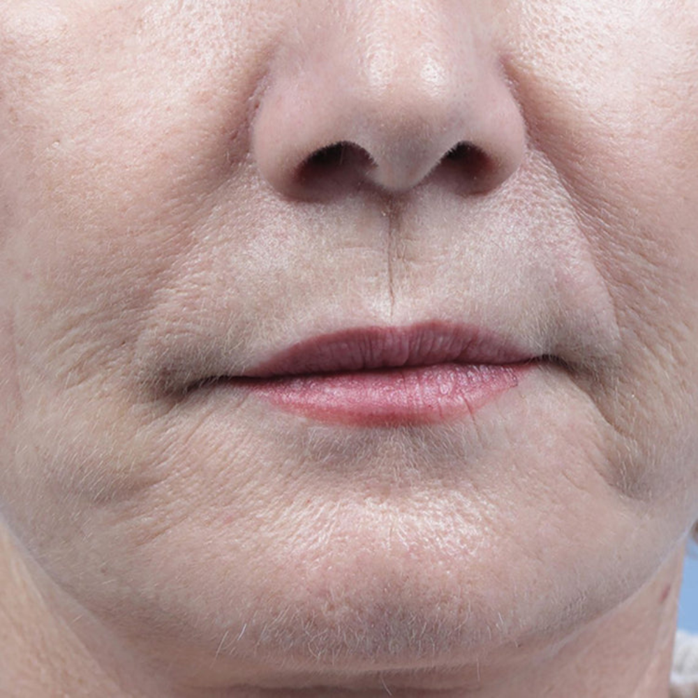 meilleure huile de pépins de figue de barbarie bio France