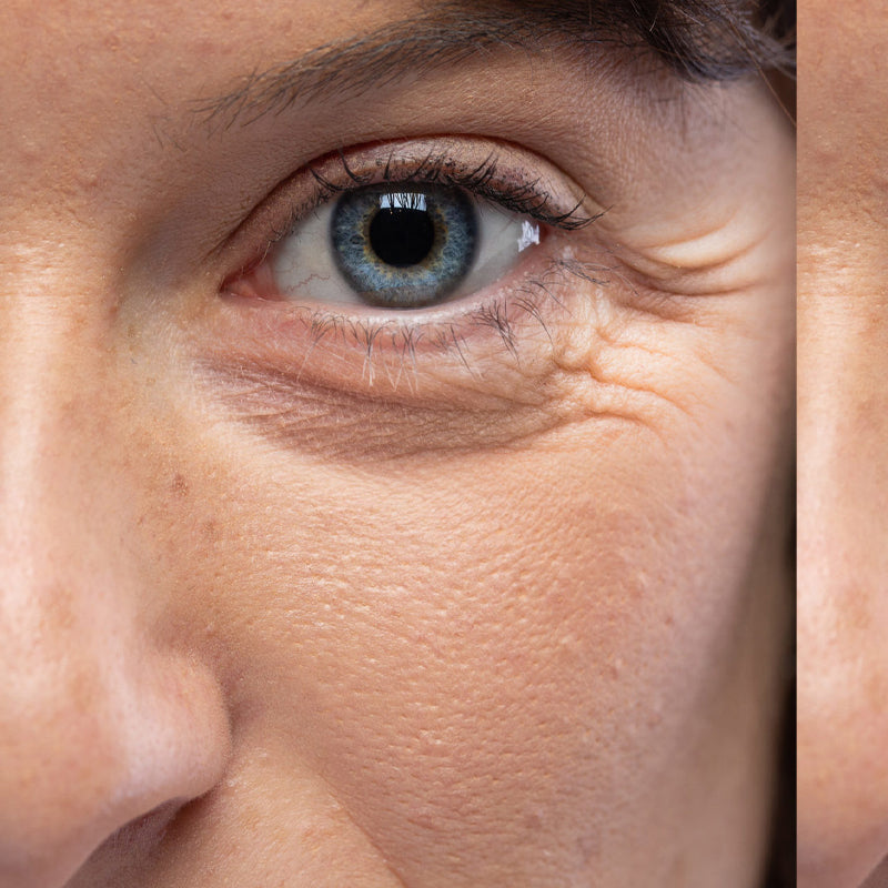 huile de figue de barbarie les ridules avant