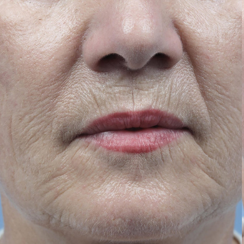 huile de figue de barbarie avant