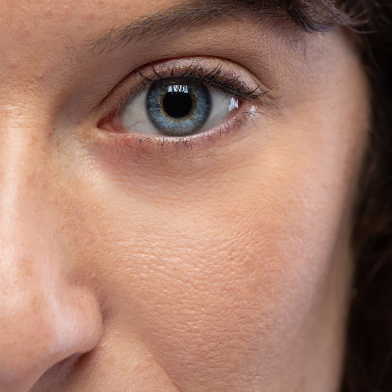 huile de figue de barbarie pour les ridulesaprèsaprès